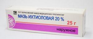 Ихтиоловая мазь от мозолей