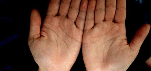 диагностика болезни по ногтям рук